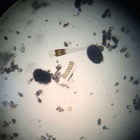 Contamination and dirt in microscopy image