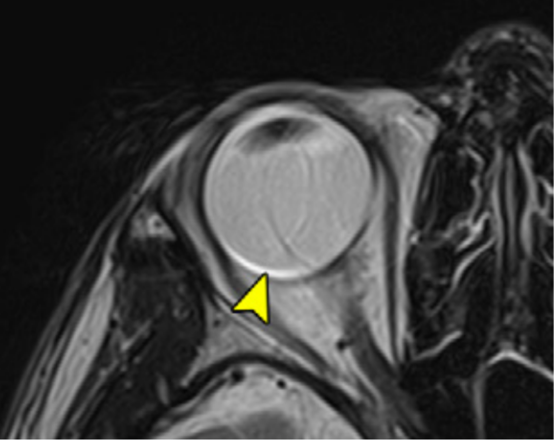 Domain-specific MRI artifact