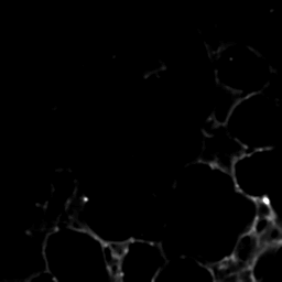 Low contrast microscopy image
