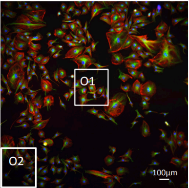Vignetting in fluorescence microscopy